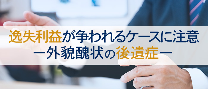 外貌醜状の後遺症では逸失利益が争われるケースに注意